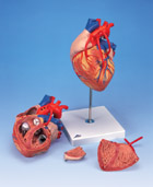 Сердце с шунтированием, 2-кратное увеличение, 4 части