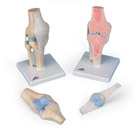 Модель коленного сустава в разрезе, состоящая из 3 частей